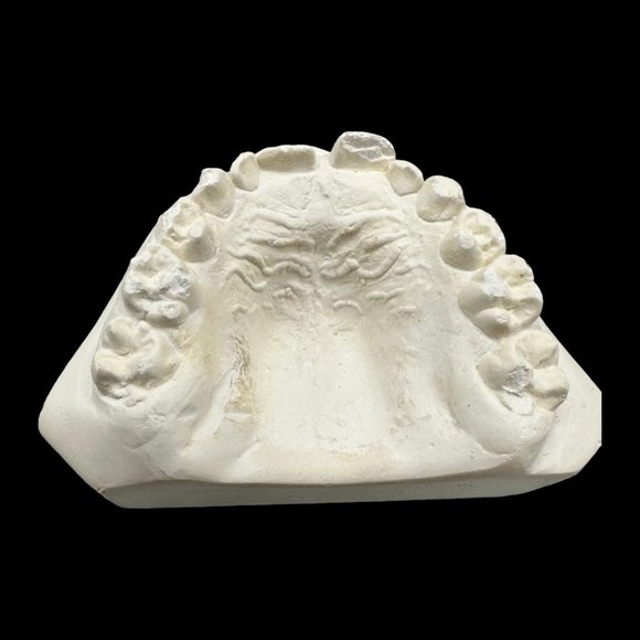 Vintage Plaster Dental Mold - Teeth Tooth Mold - Creepy Oddity - Dental Oddities - Picture 8 of 16
